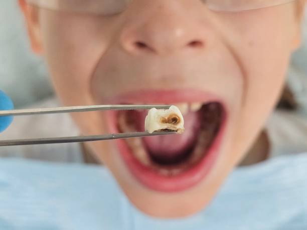 Best After-Hours Emergency Dentist in Anahuac, TX
